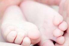 Pemerintah Harus Jamin Biaya Perawatan Bayi Berkepala Dua 