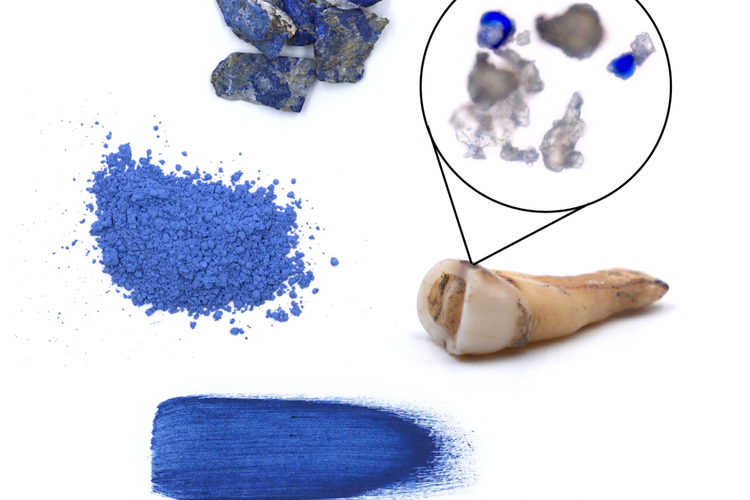 Tinta dengan pigmen biru laut yang berasal dari serpihan batu permata langka ditemukan di fosil plak gigi seorang wanita paruh baya Jerman.