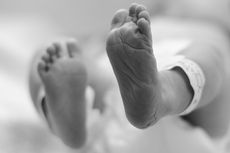 Kelainan Bawaan Mengintai Bayi Baru Lahir: Kenali dan Cegah