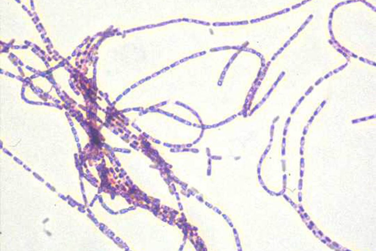 Sel bakteri antraks, Bacillus anthracis. Bakteri Bacillus anthracis penyebab penyakit antraks yang umumnya menginfeksi hewan ternak, seperti sapi dan kambing, dapat bertahan hidup sangat lama di dalam tanah.