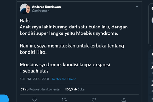 Moebius Syndrome dan Perjuangan Orangtua untuk Sang Buah Hati..