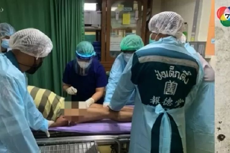 Dokter di Bangkok, Thailand, melakukan operasi melepaskan gembok yang berada di alat kelamin seorang pria.