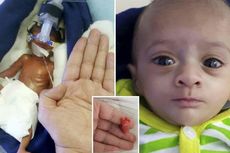 Kisah Bayi Prematur Terkecil di India Berjuang untuk Hidup