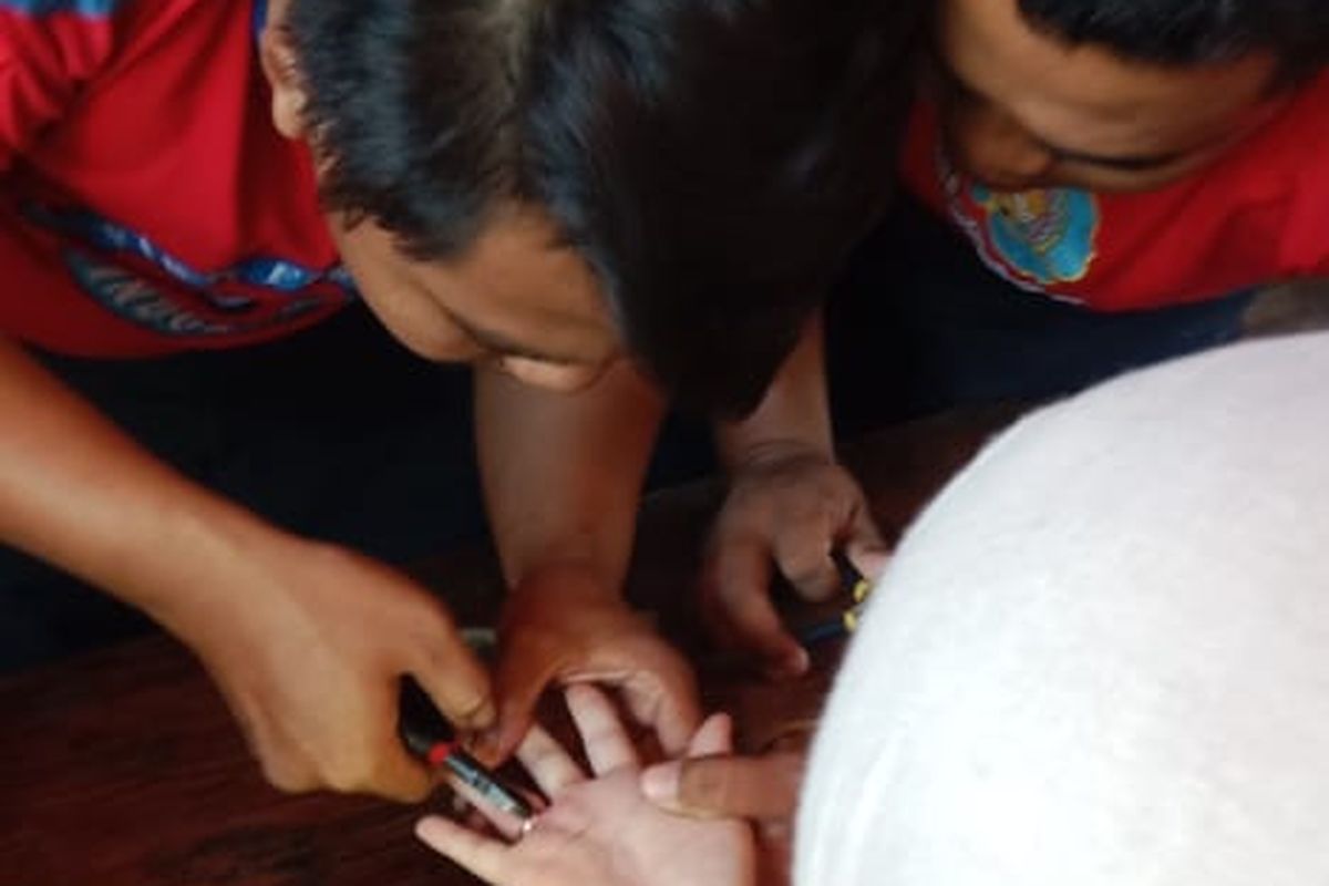 Foto: Anggota pemadam kebakaran Kabupaten Situbondo Provinsi Jawa Timur berhasil mengevakuasi cicin yang sulit lepas dari pemiliknya pada Selasa (8/4/2025). 