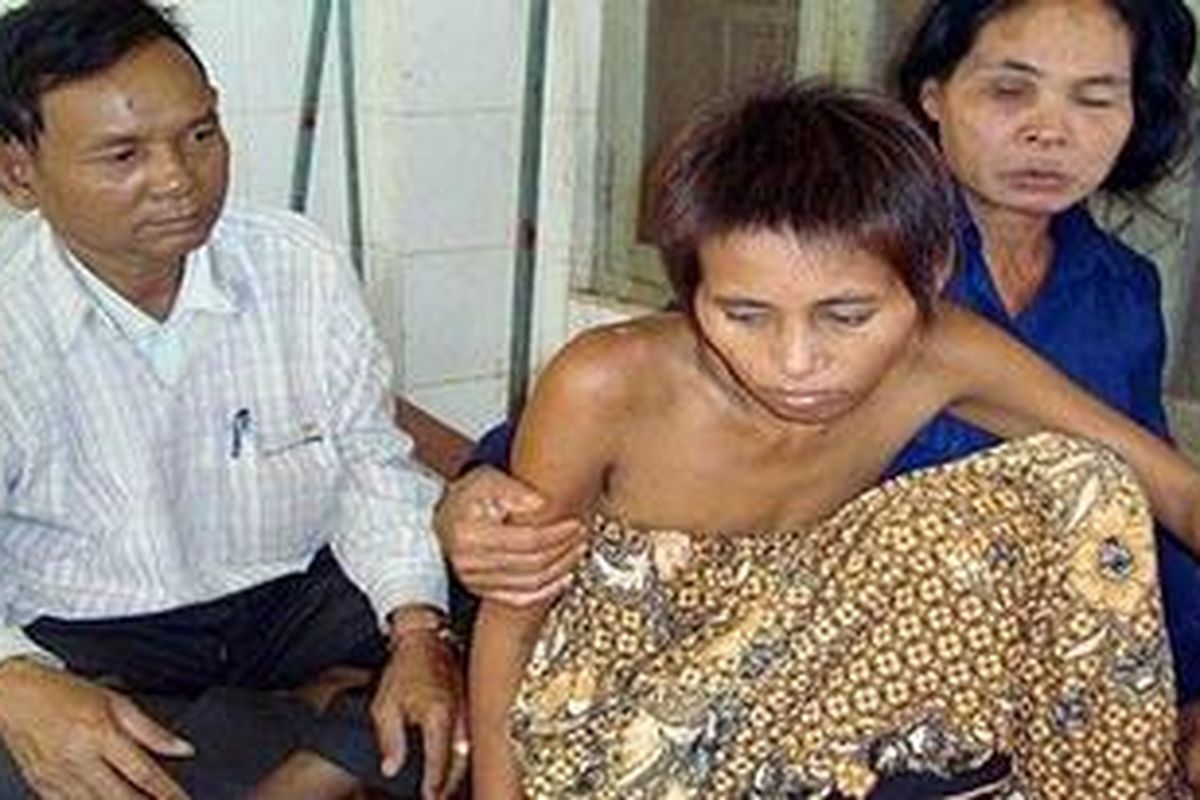 Foto ini diambil 29 Oktober 2009 yang memperlihatkan "gadis rimba" Rochom Pngieng (tengah) sedang duduk dibantu orang tuanya di sebuah rumah sakit Provinsi Ratanak Kiri, Kamboja.