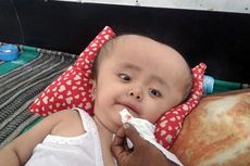 Bisakah Bayi Hidrosefalus Sembuh dan Tumbuh Normal?