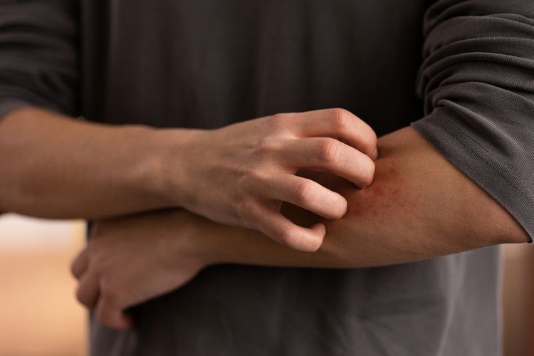 6 Cara Mengatasi Kulit Gatal di Malam Hari agar Tidur Nyenyak