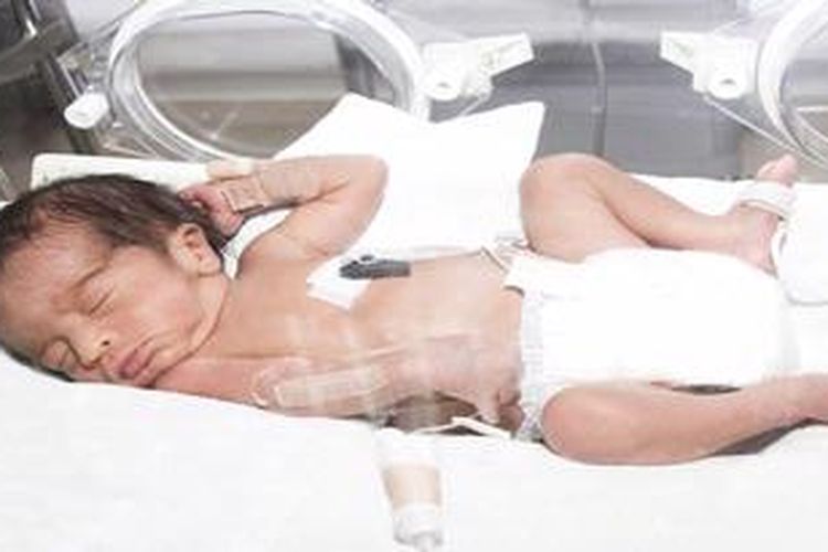 bayi mendapat perawatan di inkubator