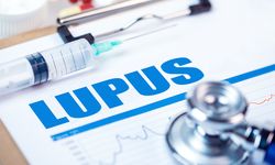 Mitos Penyakit Lupus Menular, Bagaimana Faktanya?