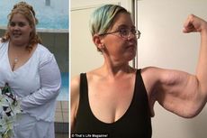 Wanita Ini Sukses Turunkan Berat Badan hingga 100 Kilogram, tetapi…  
