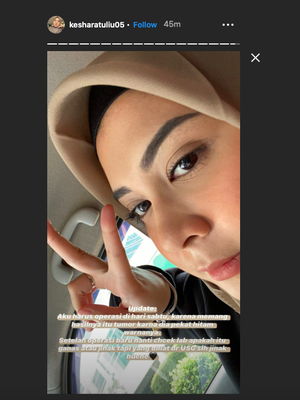 Kesha Ratuliu memberi kabar tentang hasil USG melalui Instagram Story.