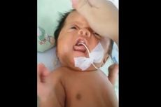 Togu Daud Gibran, Bayi Tanpa Rongga Langit-langit Rongga Mulut Butuh Uluran Tangan Netizen