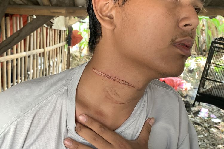 Seorang mahasiswa di Bekasi bernama History Cally Power (19) menjadi korban kabel yang menjuntai di Jalan Raya Chandrabaga, Kelurahan Kaliabang Tengah, Kecamatan Bekasi Utara, Kota Bekasi, Senin (22/1/2024).