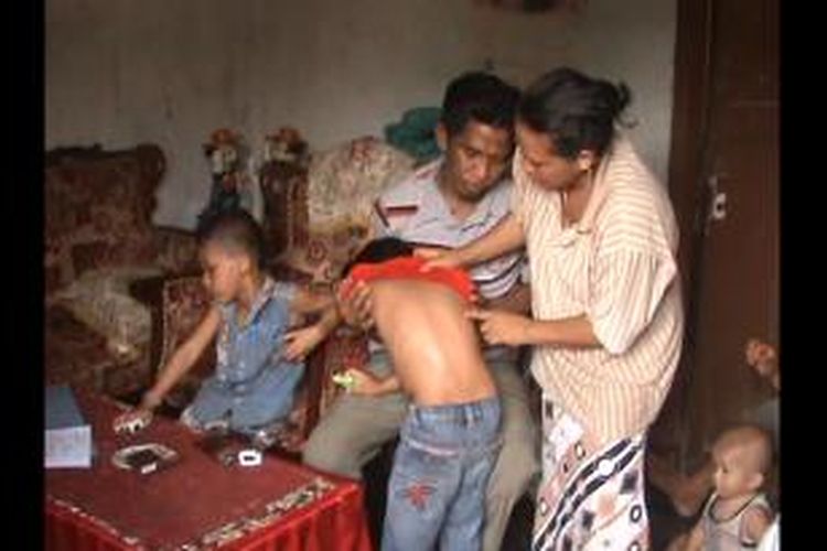 Warga memperlihatkan luka lebam dan bekas sundutan rokok pada tubuh Mirna (5) yang ditemukan menggigil kedinginan di pinggir jalan Kabupaten Gowa, Sulawesi Selatan. Sabtu, (22/11/2014).