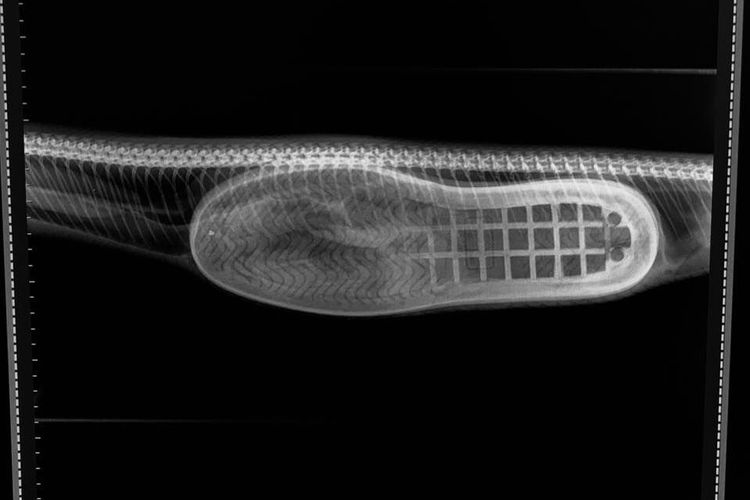 radiografi ular makan sepatu