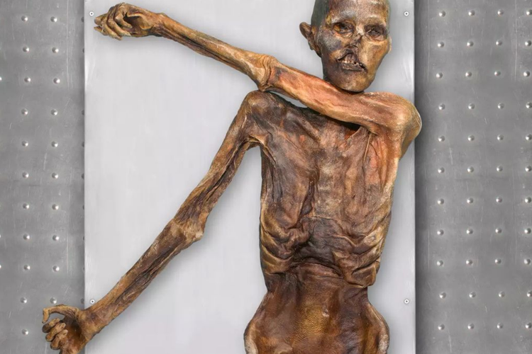 Ötzi, Mumi Paling Terkenal di Eropa. Analisis DNA manusia es dari Pegunungan Alpen ini menunjukkan, ia Ötzi mengalami kebotakan, diabetes dan obesitas.