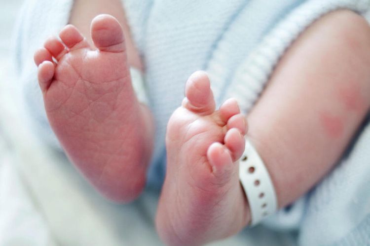 Ilustrasi bayi baru lahir. Bayi baru lahir bisa mengalami lupus neonatal. Lupus neonatal adalah penyakit autoimun langka. Gejala utamanya adalah ruam pada kulit.