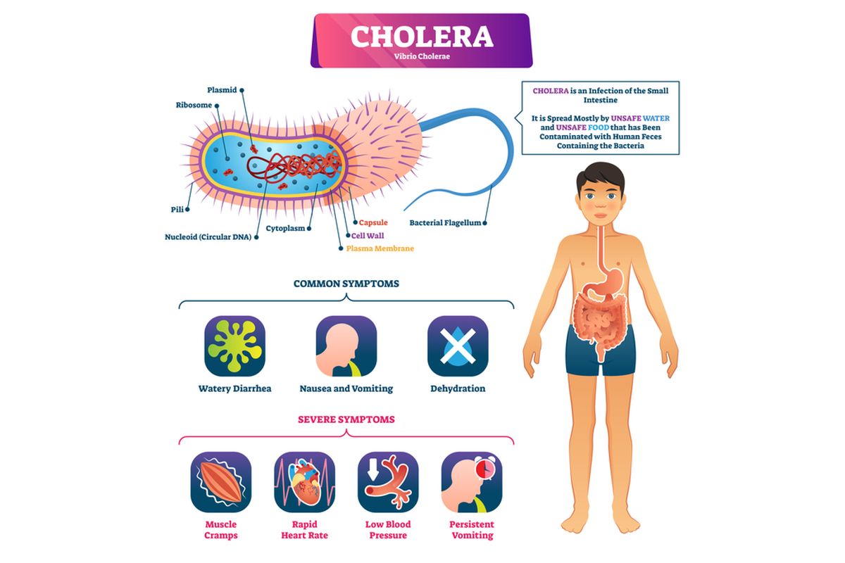Ilustrasi kolera
