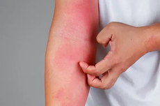 Kecewa Tanggapan JPU, Delpedro: Perkara Penghasutan Demo Bukan Soal 4 Orang, tapi...