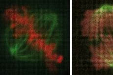 Soal UAS Biologi: Tahapan Penting Mitosis