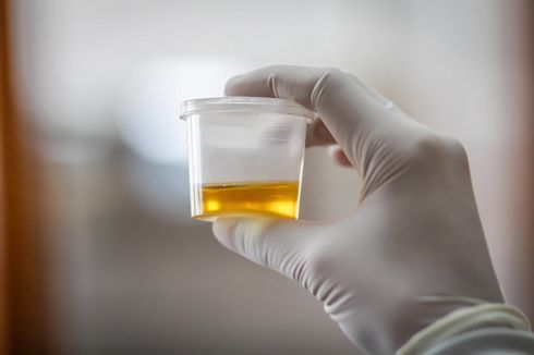 Dites Urine, Kapolres Empat Lawang Positif Menggunakan Bahan untuk Narkoba