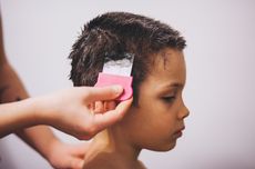 6 Penyebab Rambut Rontok pada Anak