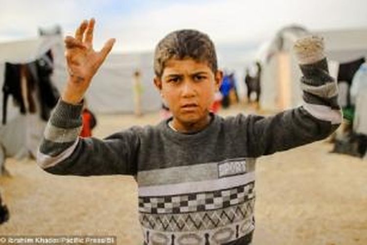 Pengungsi anak bernama Shyar Ahmad (14 tahun) ini merupakan salah satu dari banyak anak yang terluka parah karena perang dengan ISIS.