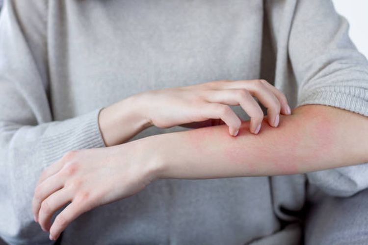 Ilustrasi kulit gatal, salah satu gejala penyakit ginjal pada kulit.