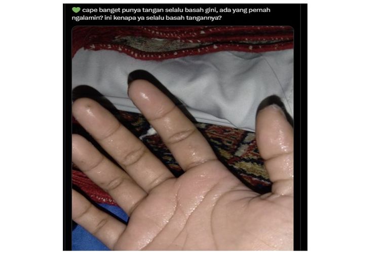 Unggahan viral berisi keluhan warganet mengenai kondisi tangannya yang kerap berkeringat