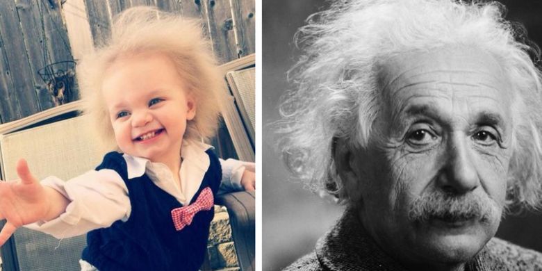 Taylor McGowan dan Albert Einstein, memiliki rambut mekar dan tak bisa disisir karena mutasi genetik.