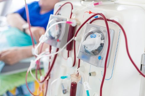 Mengenal Efek Samping Cuci Darah pada Penderita Gagal Ginjal