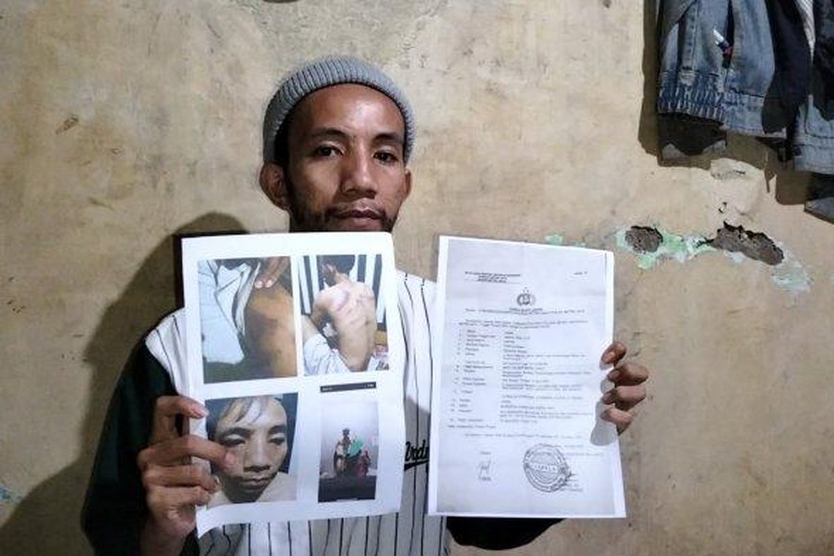 Korban penyekapan Jamal (22) menunjukkan foto-foto luka yang dideritanya dan surat laporan polisi saat ditemui di kediamannya, Pademangan, Jakarta Utara, Kamis (11/8/2022) malam. 
