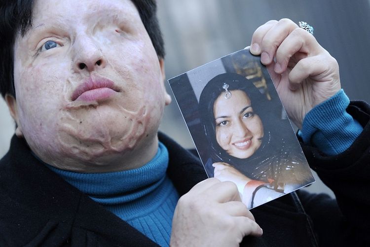 Ameneh Bahrami dari Iran berpose pada 5 Maret 2009 di Barcelona memegang foto dirinya sebelum dia dibutakan oleh seorang pria yang melemparkan air keras ke wajahnya. 


AFP PHOTO LLUIS GENE. (Photo by LLUIS GENE / AFP)