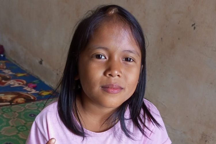 Nuriana, akrab disapa Nuri (11), salah satu penyintas kanker otak asal Pangkalan Bun, Kalimantan Tengah. Didiagnosis saat berumur 6 tahun, kini Nuri kembali sehat dan berhasil melawan kanker.