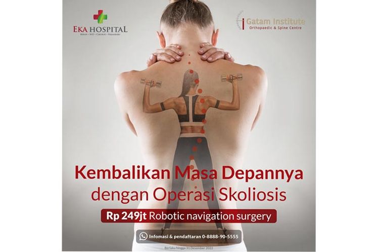 Penanganan skoliosis dari Eka Hospital. 

