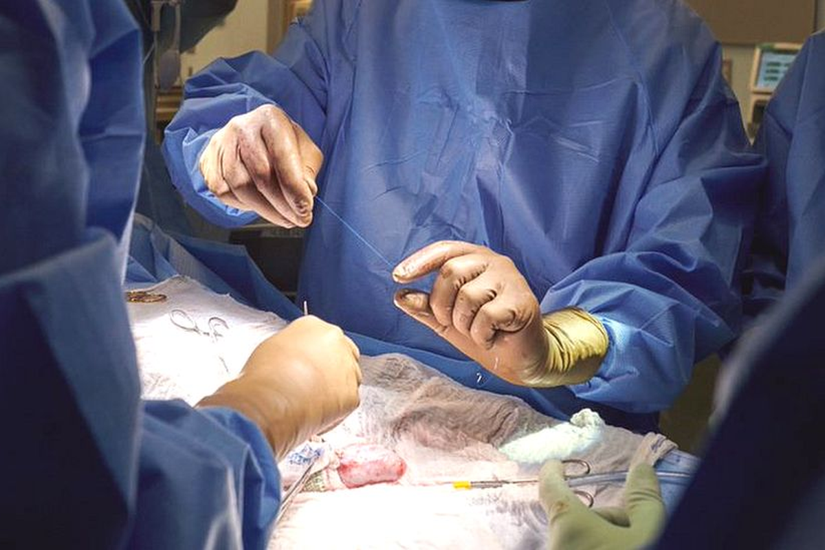 Proses operasi transplantasi ginjal babi pada manusia. [Dok. New York University Langone Health Via BBC]