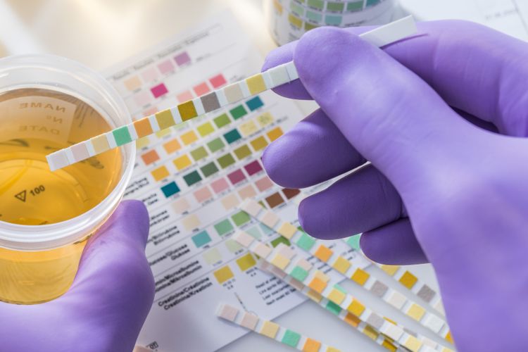 Ilustrasi warna urine