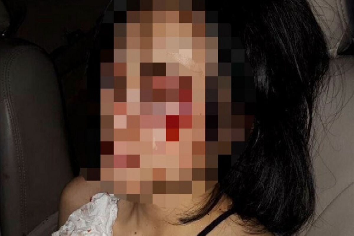 Foto wanita korban begal yang beredar di aplikasi pesan singkat, Senin (6/11/2017).