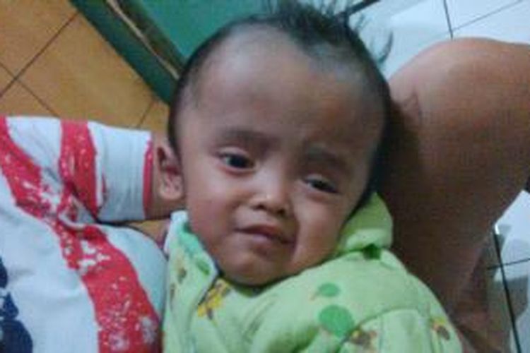 Alif Rizky Ramadhan, bayi berusia 1,5 tahun yang menderita penyakit hydrocephalus sedang dalam pangkuan ibunya di rumah kakeknya di Gg. Banceuy, RT 05 RW 07 Kelurahan Braga, Kecamatan Sumur Bandung, Bandung, Jawa Barat, Rabu, (5/2/2014)