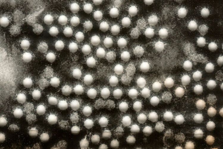 Virus polio penyebab penyakit polio pada anak. Virus polio terdeteksi di limbah kotoran manusia di Inggris.