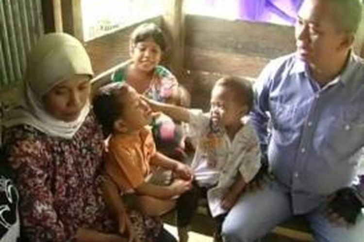 Bocah Ali bersama dengan keluarganya saat dikunjungi  Bupati Polewali Mandar Andi Ibrahim Masdar.