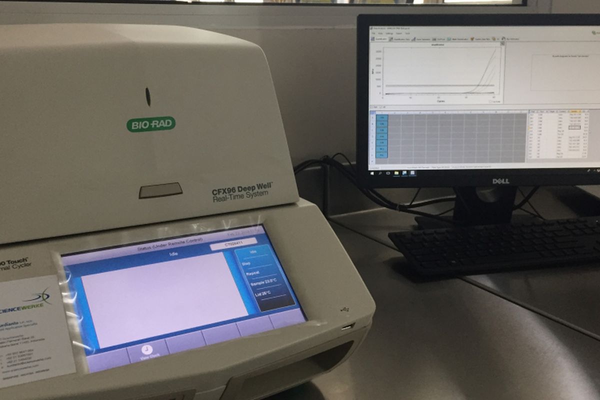 Teknologi Polymerase Chain Reaction (PCR) merupakan teknologi yang mampu mendeteksi bahan haram yang terkandung dalam suatu produk. 