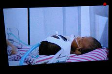 Dokter: Bayi Kembar Siam Asal Sumbawa Tidak Mungkin Dipisahkan