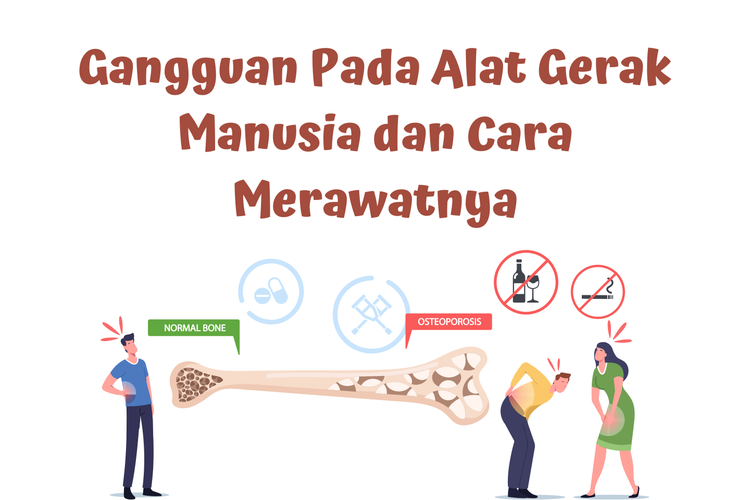 Ilustrasi gangguan alat gerak manusia