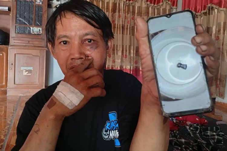Cari Pakan Ternak di Sawah, Warga Madiun Tertembak Peluru Nyasar di Pipi