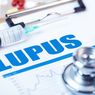Mitos Penyakit Lupus Menular, Bagaimana Faktanya?
