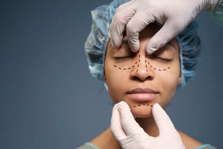 Terdapat beberapa jenis rhinoplasty (bedah plastik hidung), dari yang pakai silikon sampai hybrid.