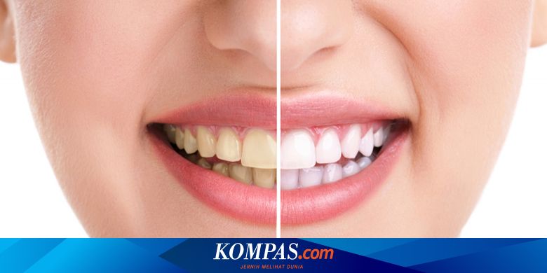 Kenali Kebiasaan Yang Bikin Warna Gigi Menguning Halaman All Kompas Com