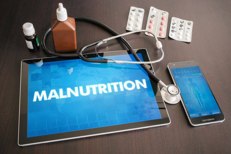 Malnutrisi adalah suatu status gizi akibat defisiensi atau kelebihan (imbalans) dari energi, protein, dan zat gizi lainnya, yang menyebabkan gangguan pada jaringan/tubuh (bentuk, ukuran, komposisi), fungsi tubuh dan luaran/hasil klinis.