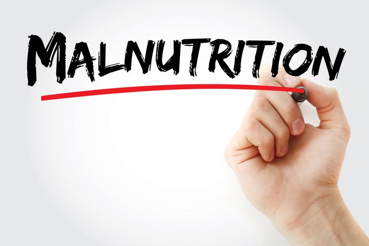 Malnutrisi sebagai salah satu penyebab penyakit busung lapar